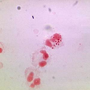 PREP Antibody (Center)