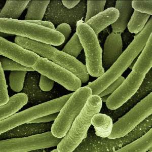 Recombinant Human PREP Protein, His, E.coli-2ug